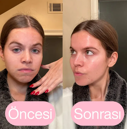 Koreanlea 3D Lifting Sıkılaştırıcı Botoks Etkili Maske